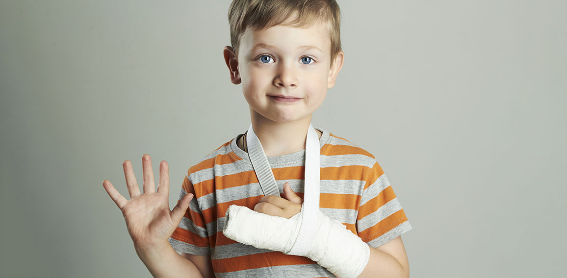 little boy in a cast.child with a broken arm.after accident