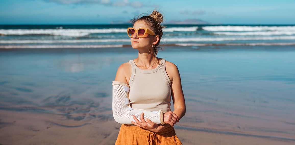 Woman with broken arm on beach. Arm cast, injured during family vacation in holiday resort. Concept of beach summer vacation.